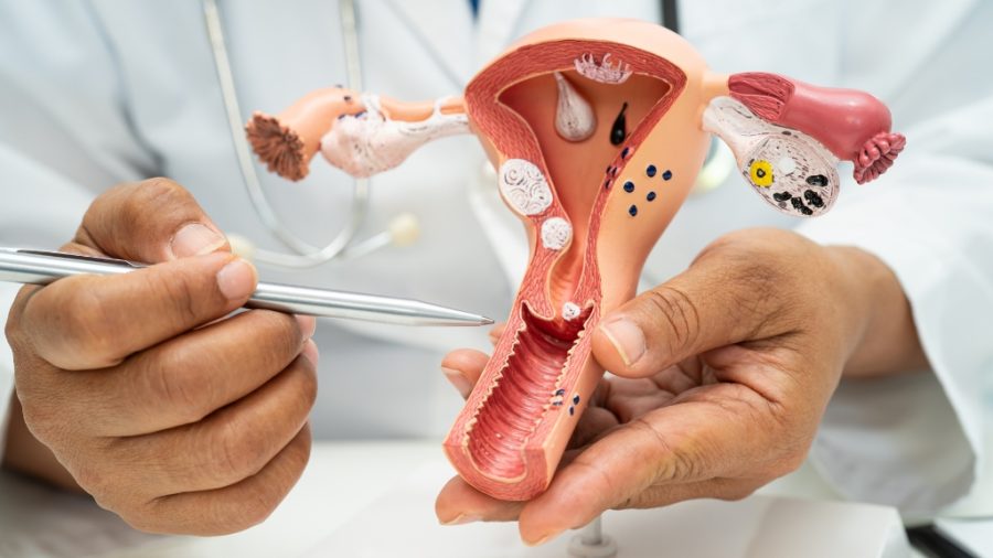 Câncer Ginecológico: Prevenção e Acompanhamento São Cruciais